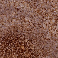 TMEM42 Antibody, Novus Biologicals:Antibodies:Primary Antibodies